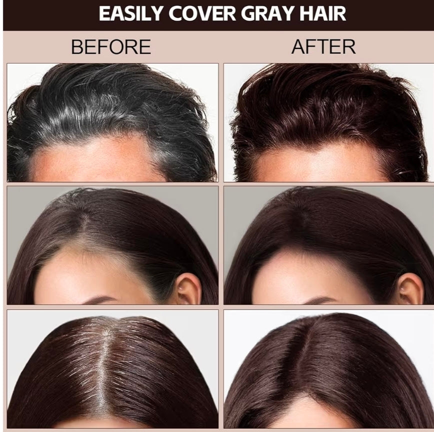 Barra Premium para Canas 3 en 1