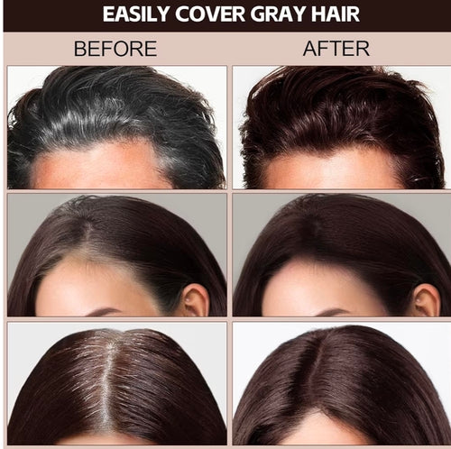 Barra Premium para Canas 3 en 1